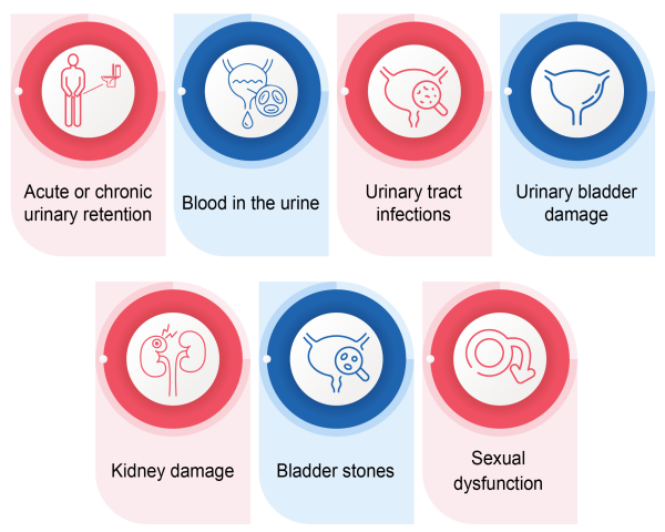 PES-Benign Prostatic Hyperplasia_Rec_v1.0_12Aug24-09