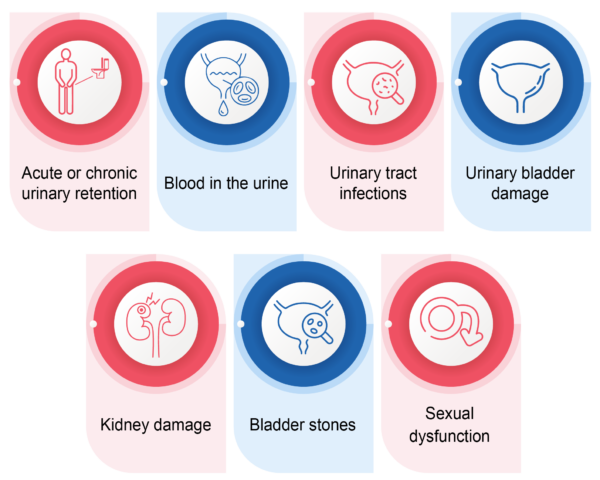 PES-Benign Prostatic Hyperplasia_Rec_v1.0_12Aug24-09